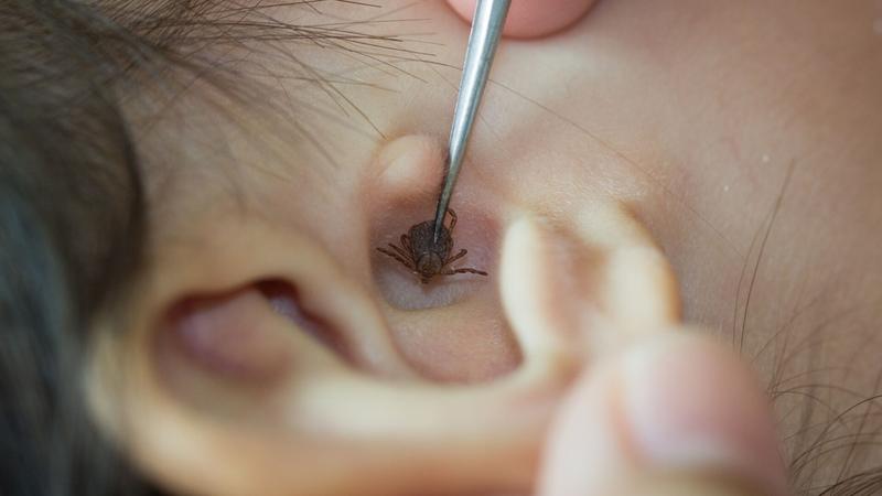 Zagrożenia zdrowotne kleszcza