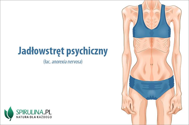 Przyczyny braku apetytu u psa