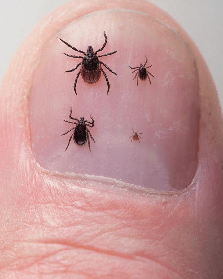 Kiedy do lekarza po kleszczu